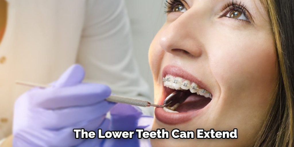The Lower Teeth Can Extend 