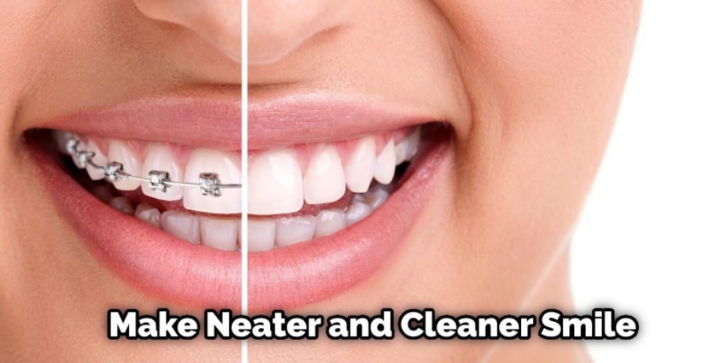 Make Neater and Cleaner Smile