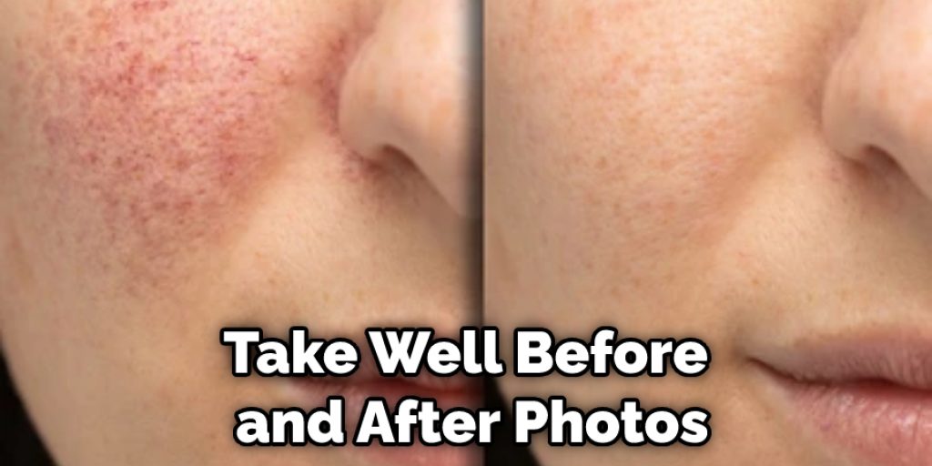 Take Well Before and After Photos