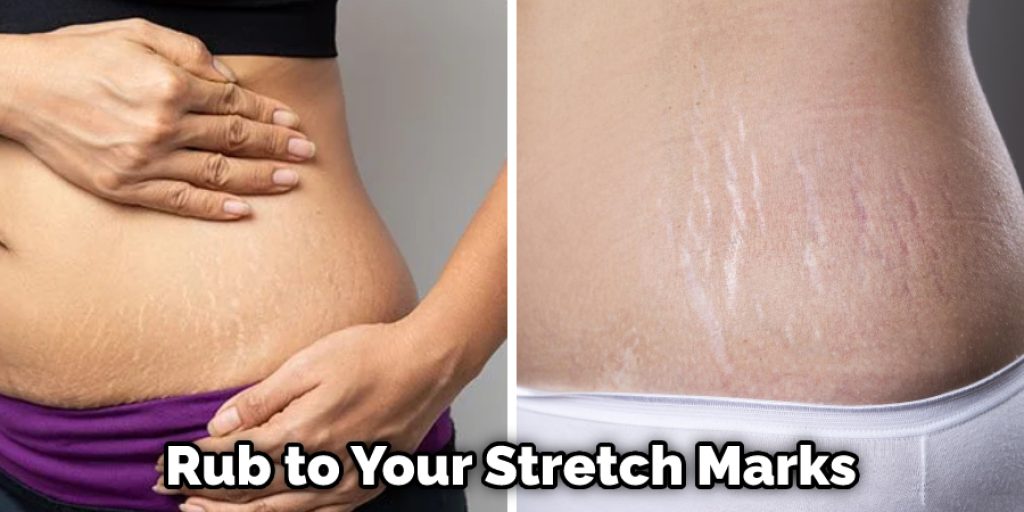 Rub to Your Stretch Marks