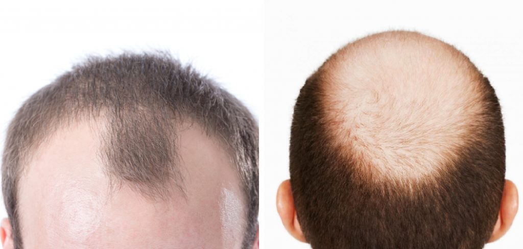 How To Fix Uneven Hair Growth