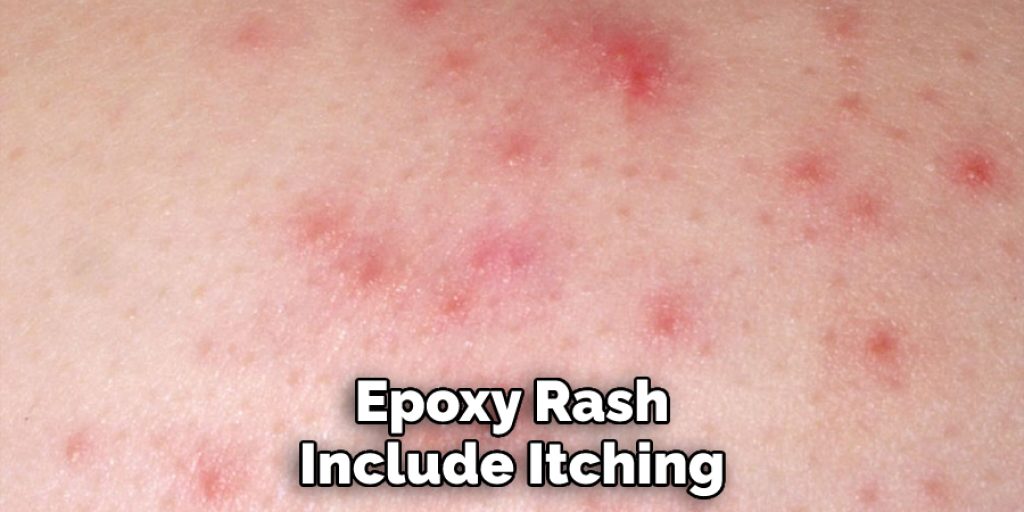 Epoxy Rash Include Itching