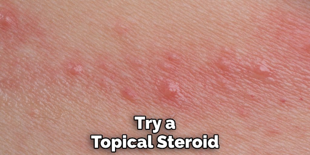 Try a Topical Steroid