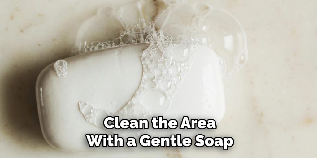 Clean the Area
With a Gentle Soap