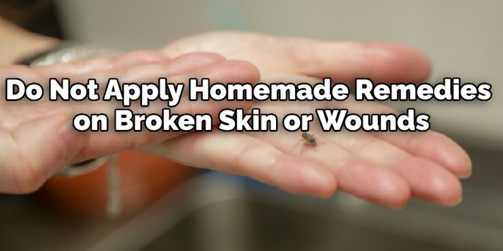 Do Not Apply Homemade Remedies