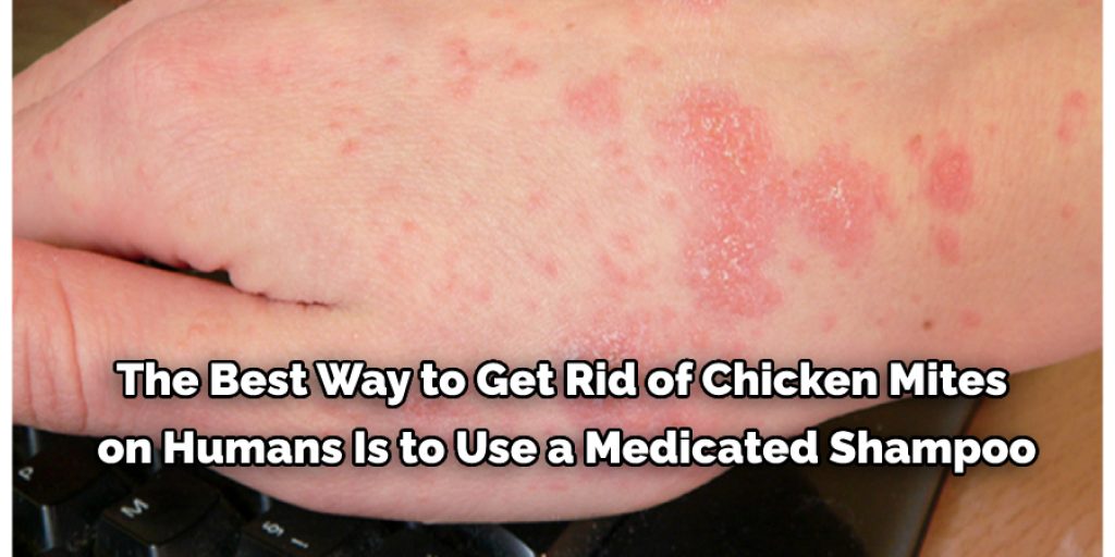 How to Get Rid of Chicken Mites in Your House 10 Effective Steps (2024)