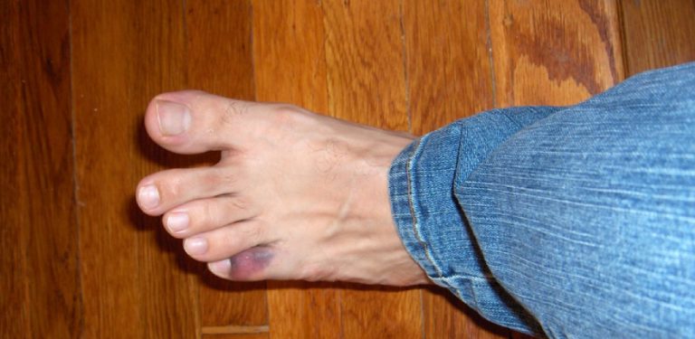 how-to-shower-with-a-broken-foot-apply-these-10tricks-2023