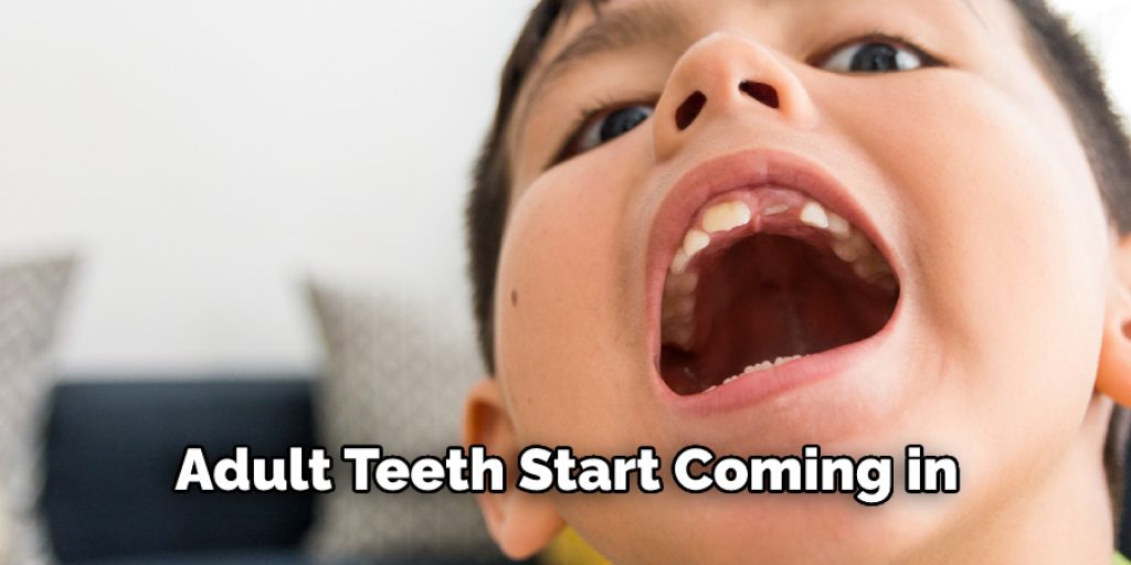 Adult Teeth Start Coming in