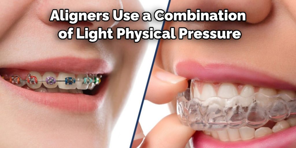 Aligners Use a Combination of Light Physical Pressure