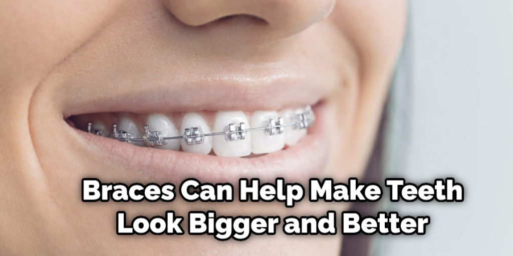 Braces Can Help Make Teeth Look Bigger and Better