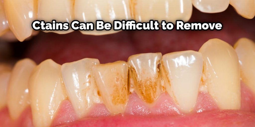 Even if you brush and floss regularly, these stains can be difficult to remove.