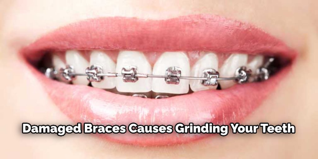 Damaged Braces Causes Grinding Your Teeth