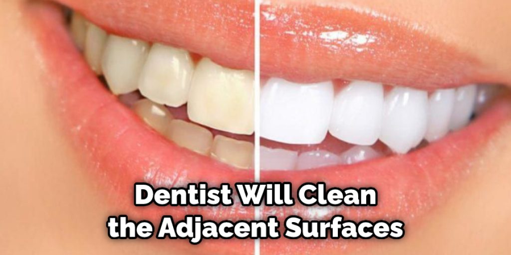 Dentist Will Clean the Adjacent Surfaces