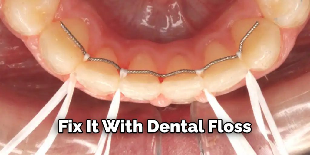 Fix It With Dental Floss