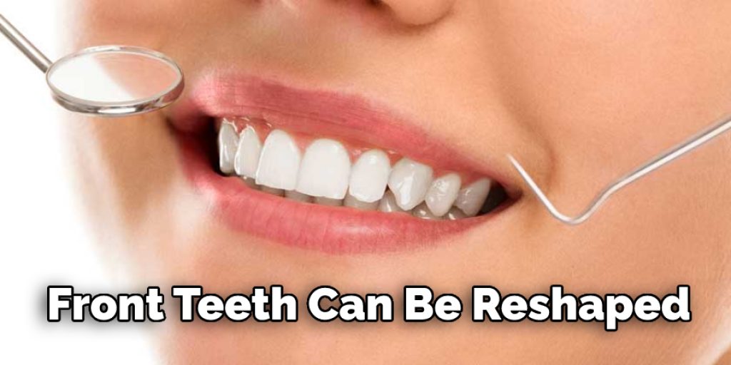 Front Teeth Can Be Reshaped