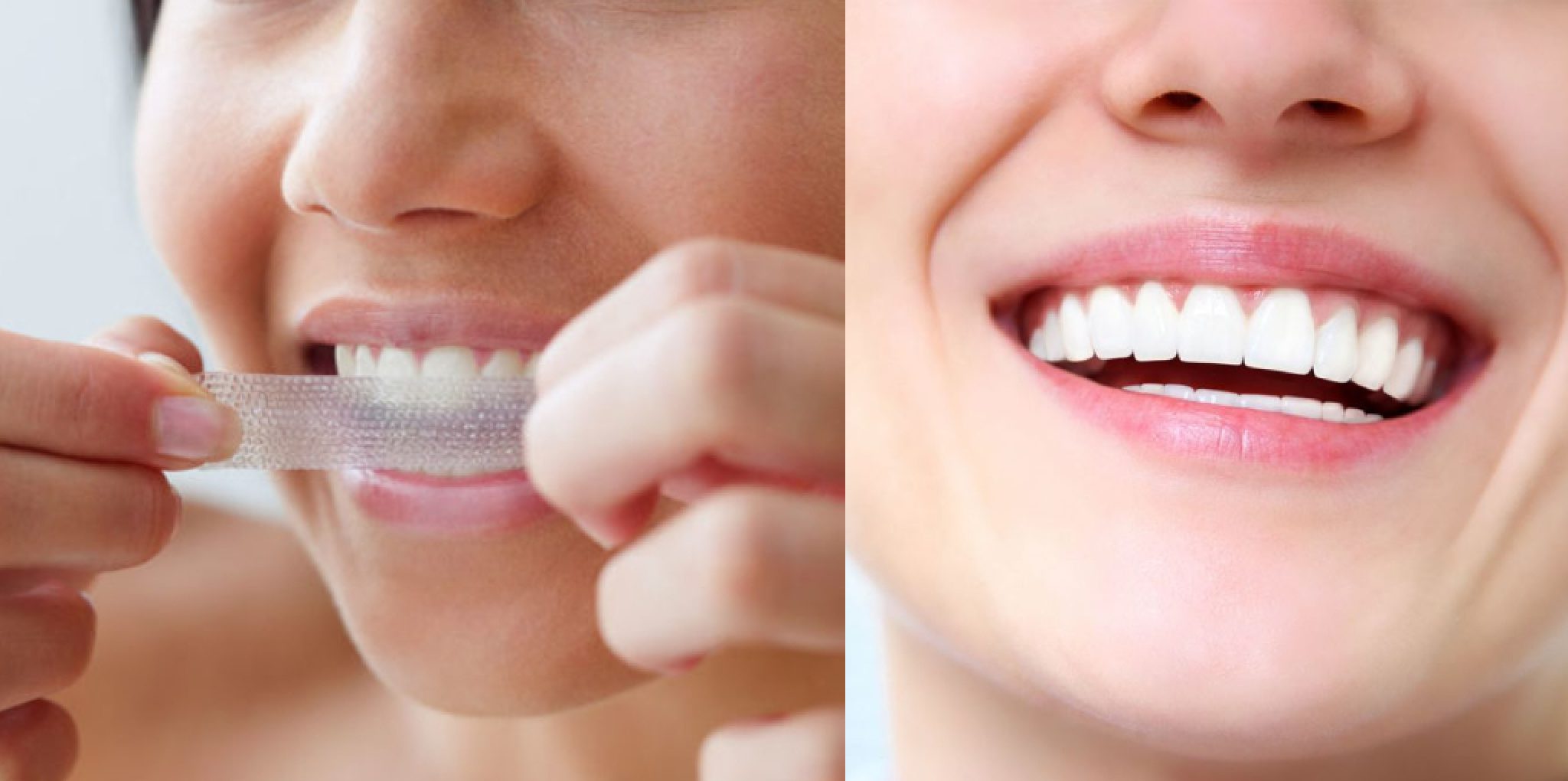 how-old-do-you-have-to-be-to-use-teeth-whitening-strips-2023