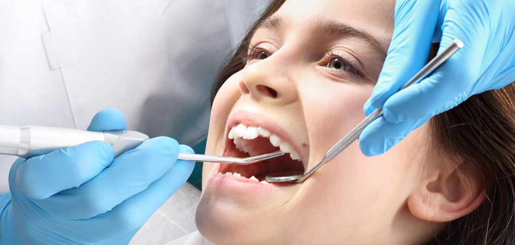 How to Whiten Fillings on Teeth