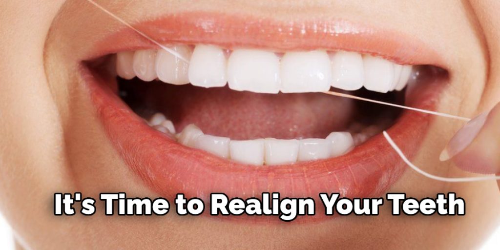 It's Time to Realign Your Teeth