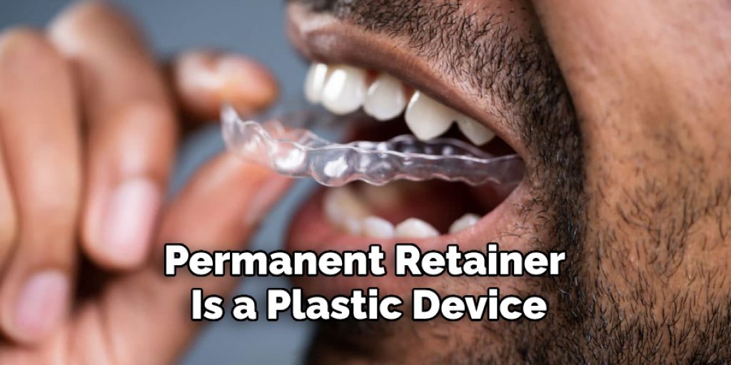 Permanent Retainer Is a Plastic Device
