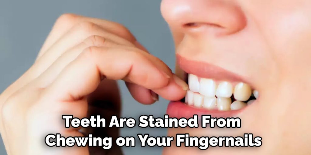 teeth are stained from chewing on your fingernails