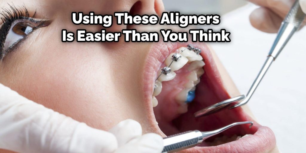 Using These Aligners Is Easier Than You Think