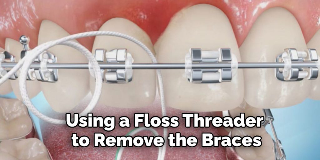 Using a Floss Threader to Remove the Braces