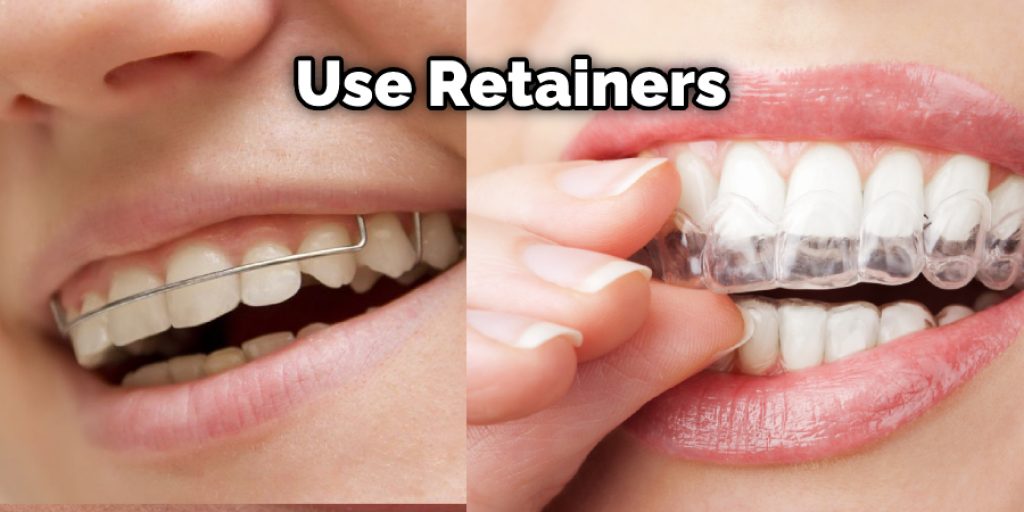 Many adults are going to adult braces to correct these issues without having to use retainers.