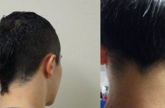 How-to-Get-Rid-of-a-Rat-Tail-Hair