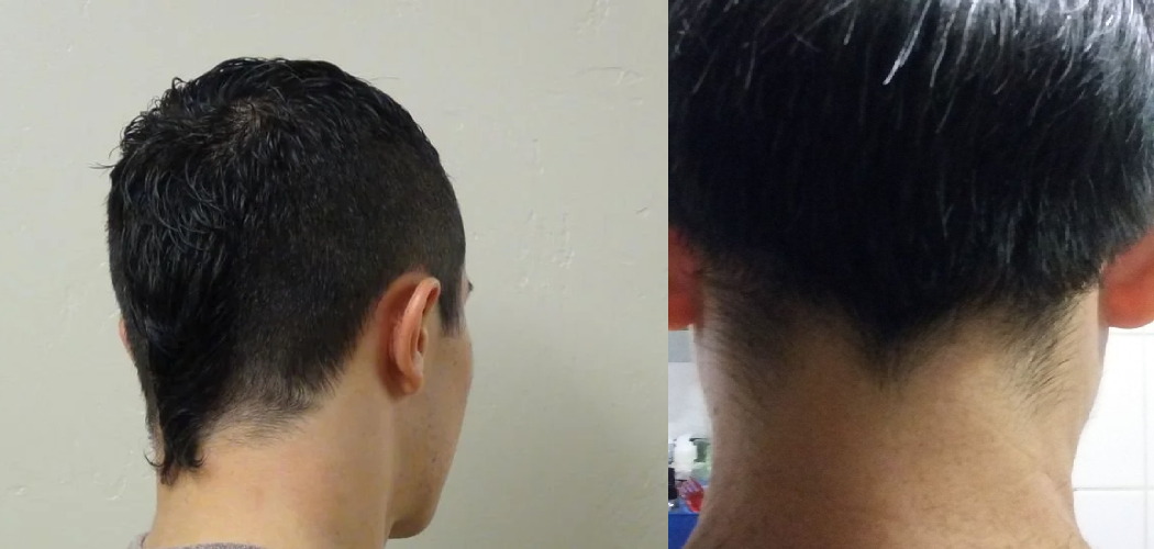 How to Get Rid of a Rat Tail Hair
