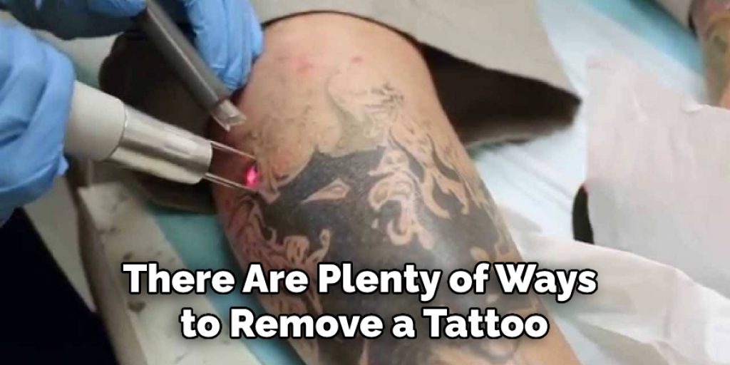 There Are Plenty of Ways to Remove a Tattoo