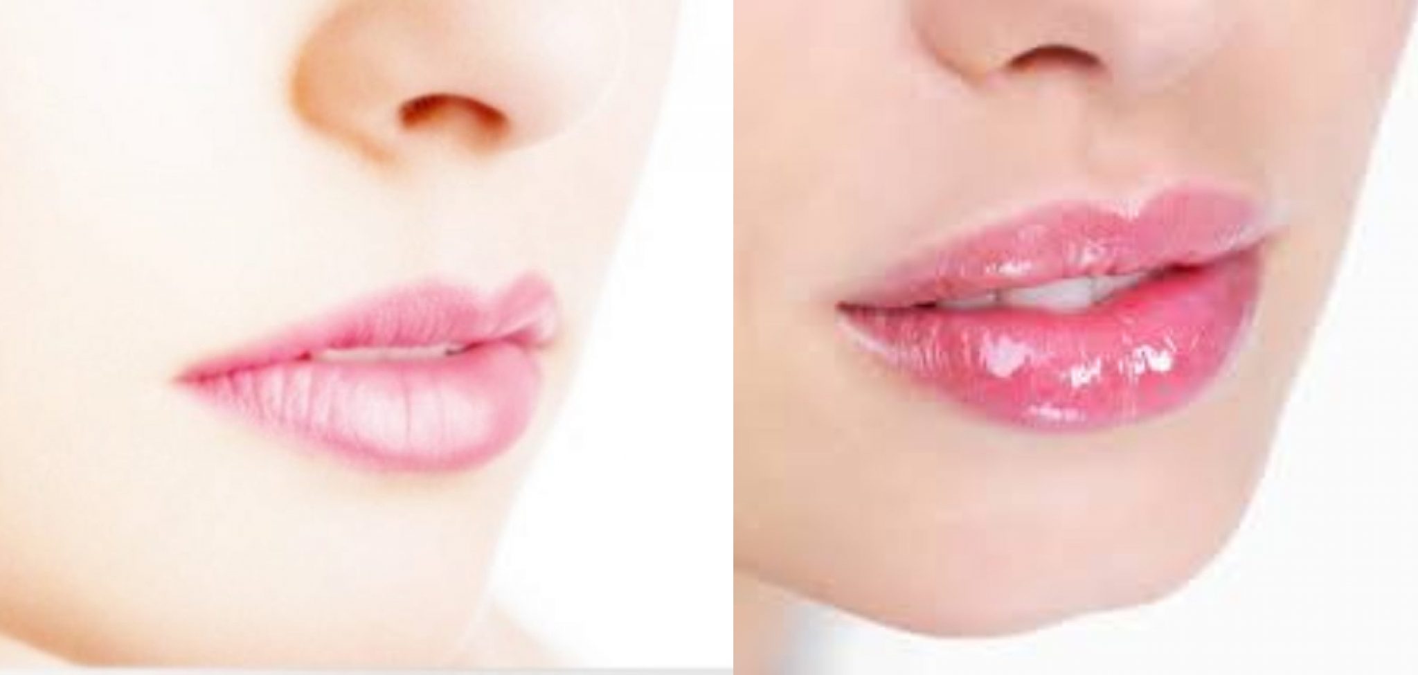 How To Make Your Lips Smaller Without Makeup 10 Effective Ways 1341