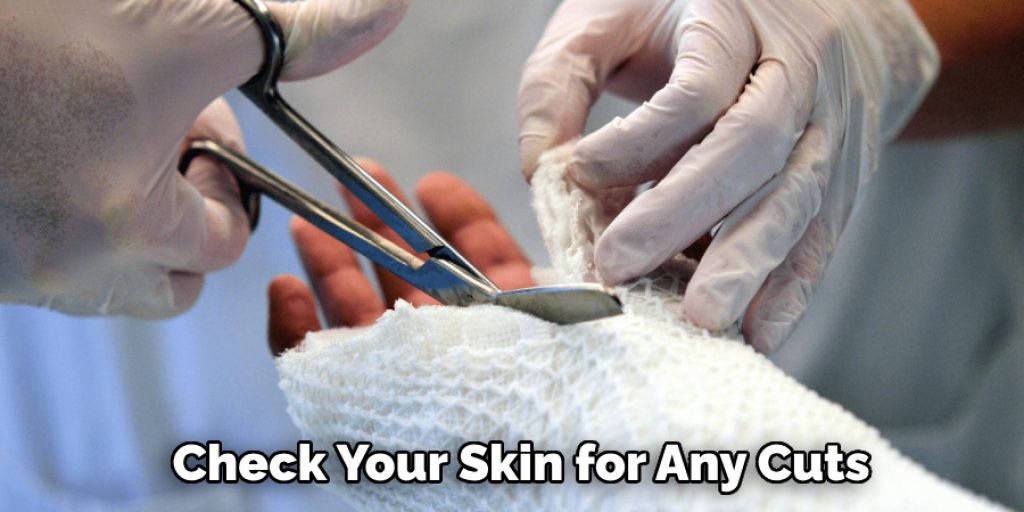 Check Your Skin for Any Cuts