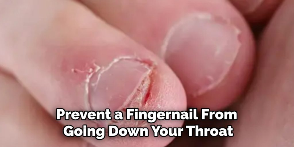 Prevent a Fingernail From Going Down Your Throat