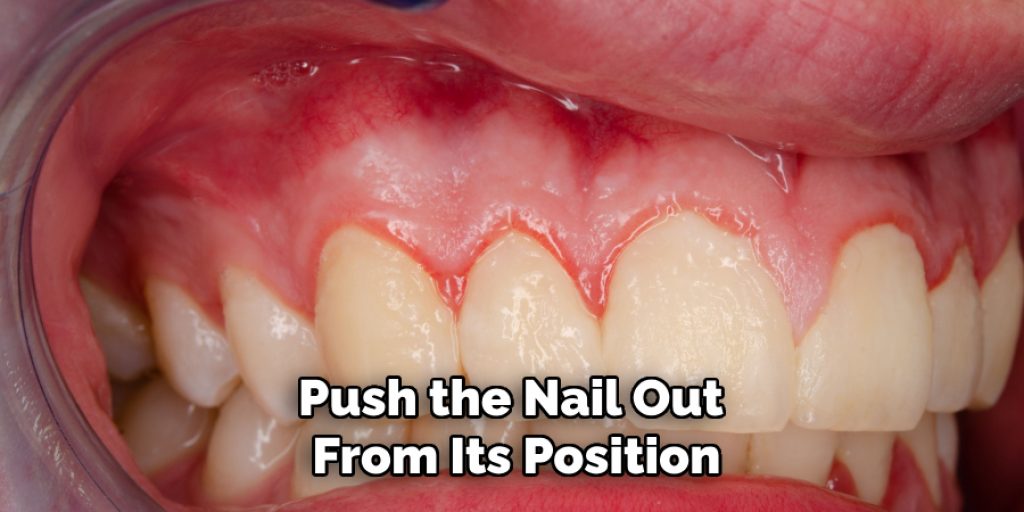 Push the Nail Out From Its Position